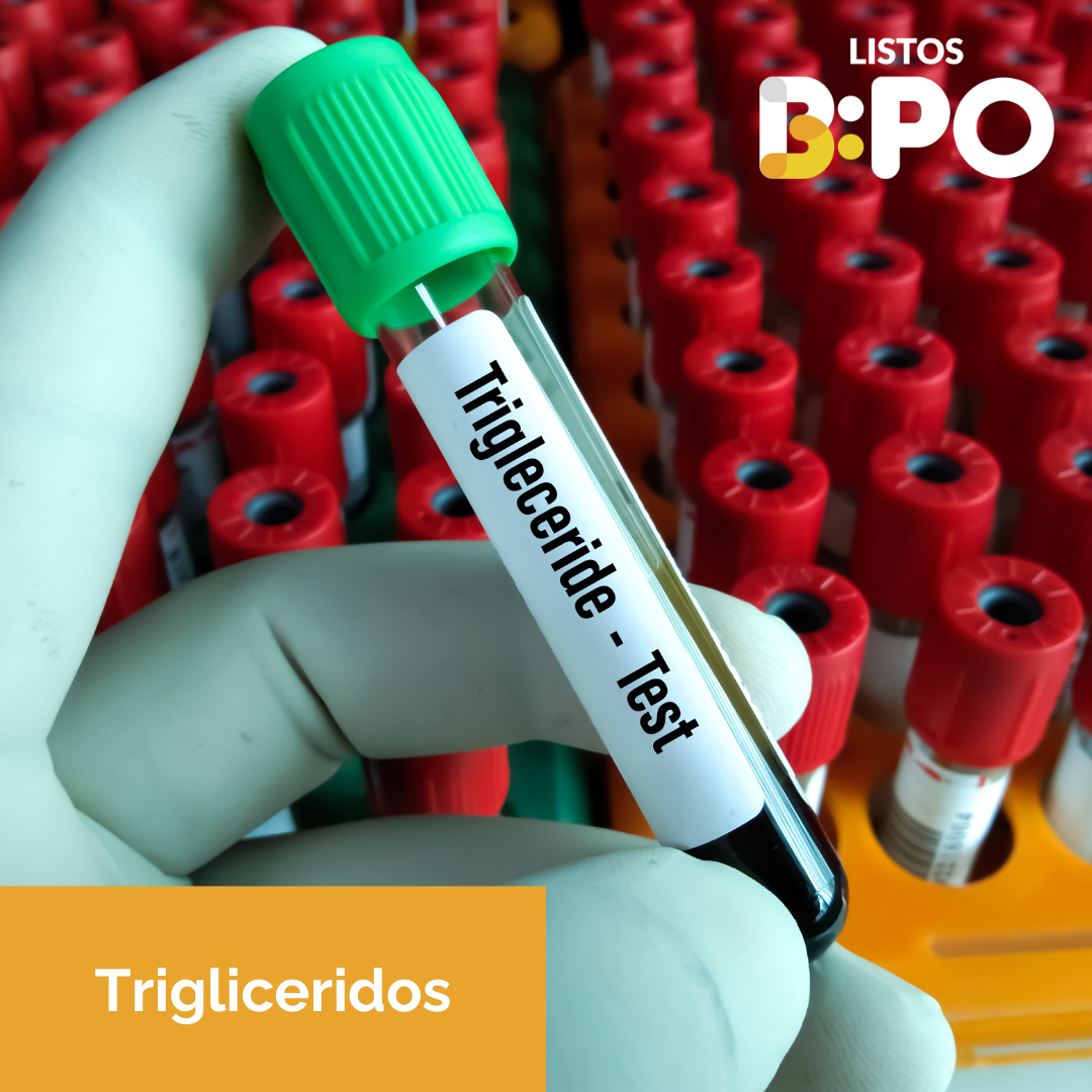 Trigliceridos