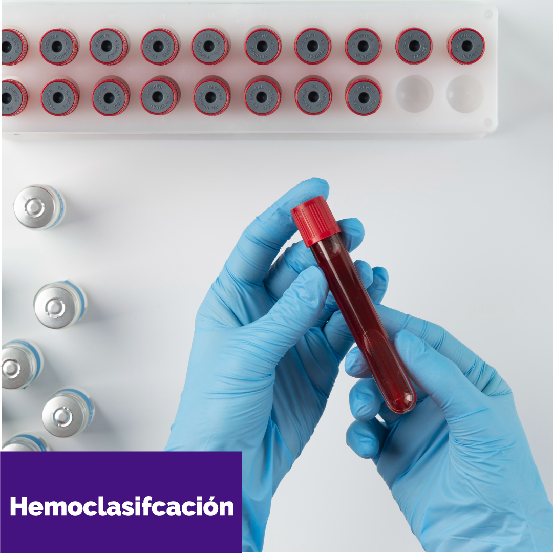 HEMOCLASIFICACIÓN